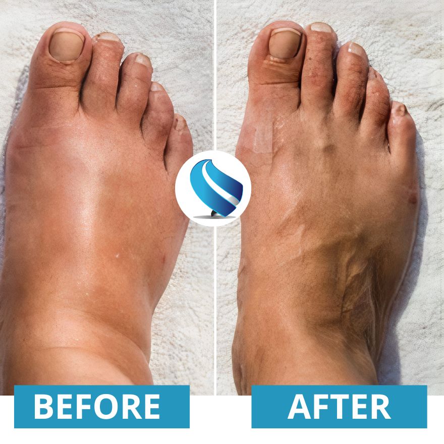 Experience the EMS Foot Massager: a modern solution for tackling cramps, swollen ankles, rigidity, and aches in your feet. This device uses electric pulses to quickly improve blood flow, diminish varicose veins, and provide your legs with a revitalizing lightness.