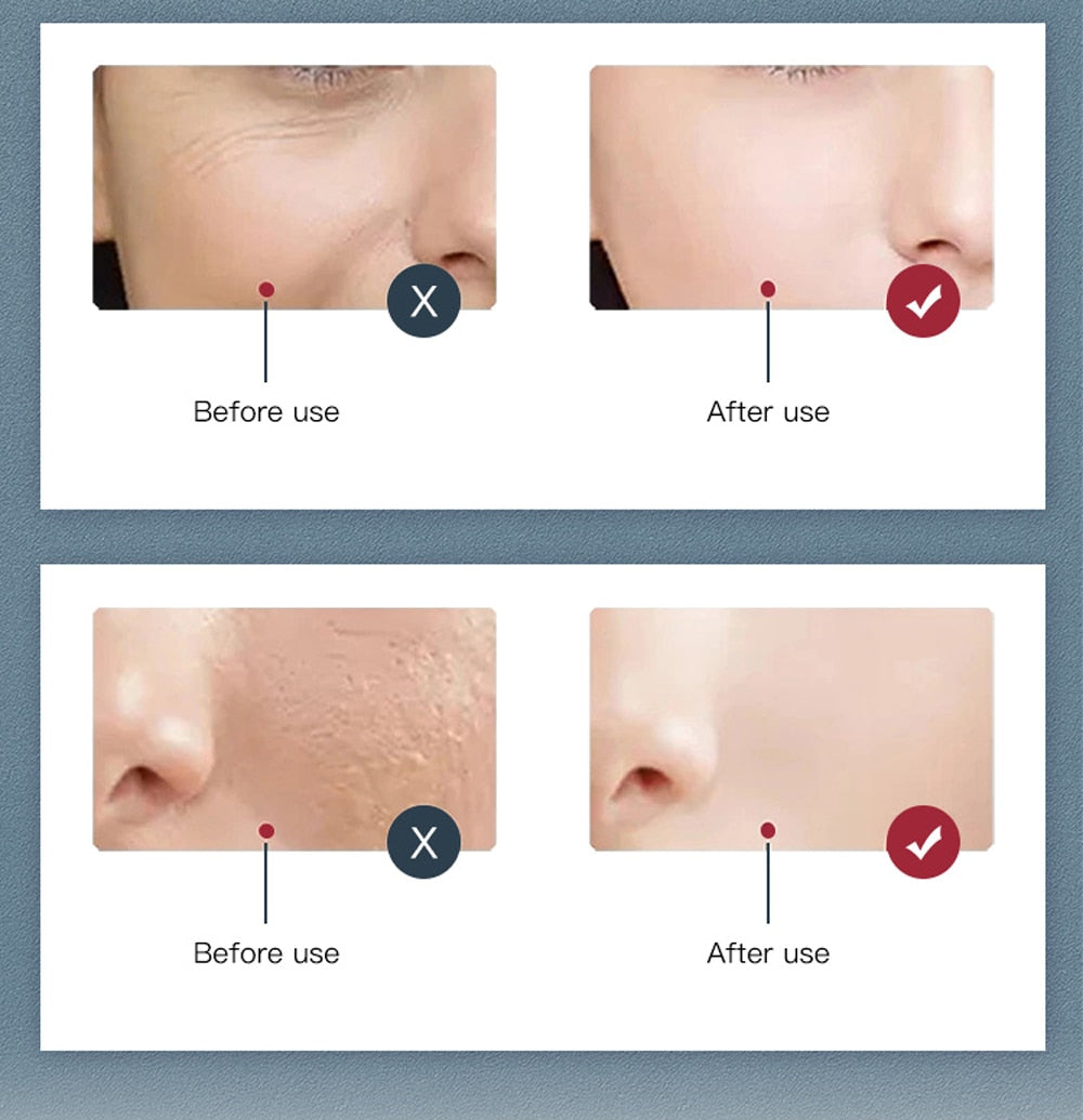 7 Colors LED Facial Mask PDT Light Therapy Emporium Discounts